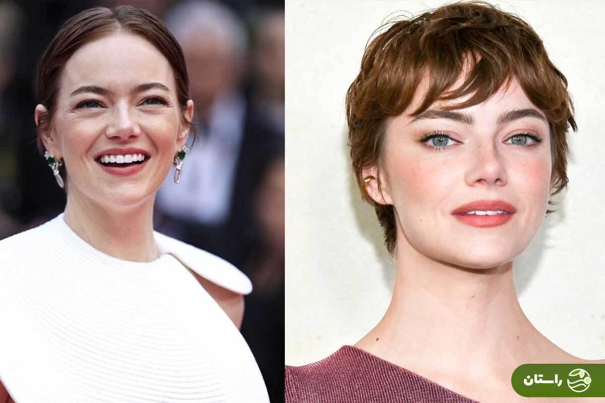 اما استون بر اساس نسبت طلایی یونان باستان زیباترین زن جهان شد