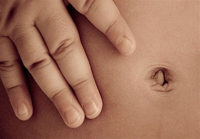 ناف شما تو رفته است یا برآمده؛ دلیل آن چیست؟ ناف شما تو رفته است یا برآمده؛ دلیل آن چیست؟