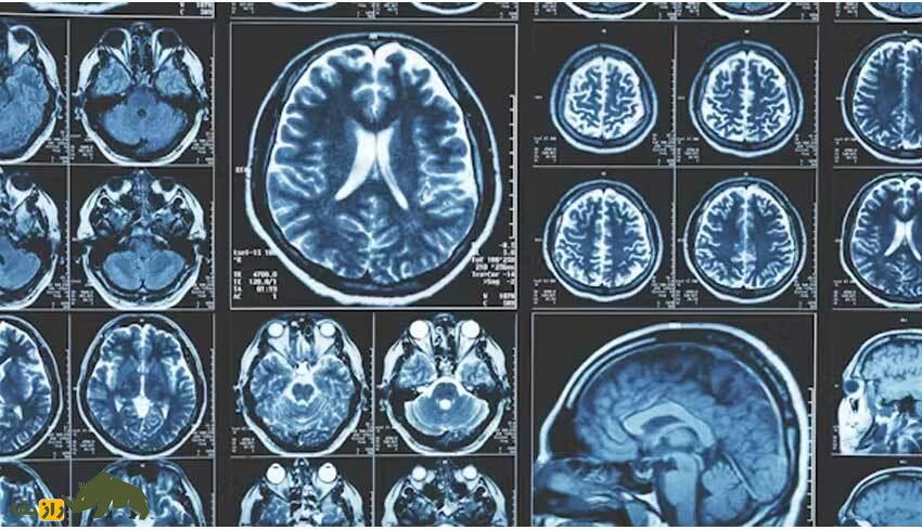 چه چیزی در مغز انسان هست که او را از حیوانات باهوشتر میکند؟ چه چیزی در مغز انسان هست که او را از حیوانات باهوشتر میکند؟