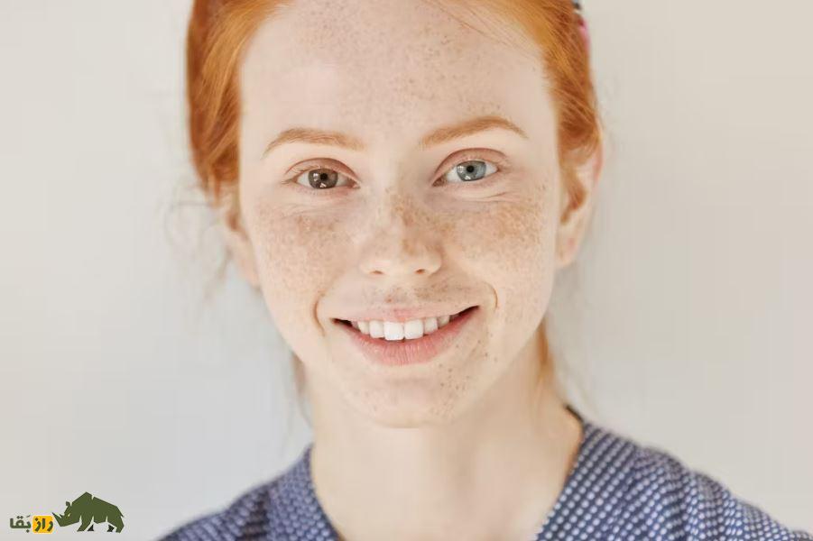 رنگ چشم چطور ساخته می‌شود و چرا چشم‌هایی با رنگ‌های متفاوت داریم؟