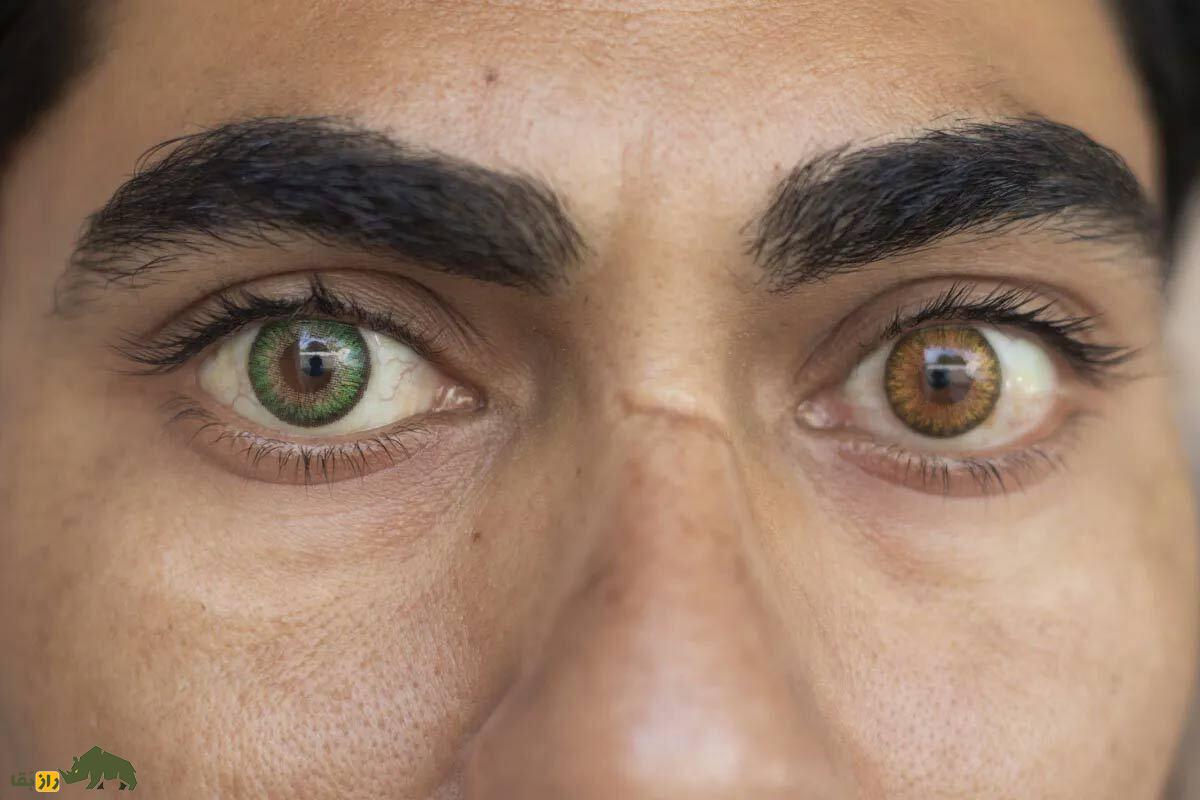 رنگ چشم چطور ساخته می‌شود و چرا چشم‌هایی با رنگ‌های متفاوت داریم؟