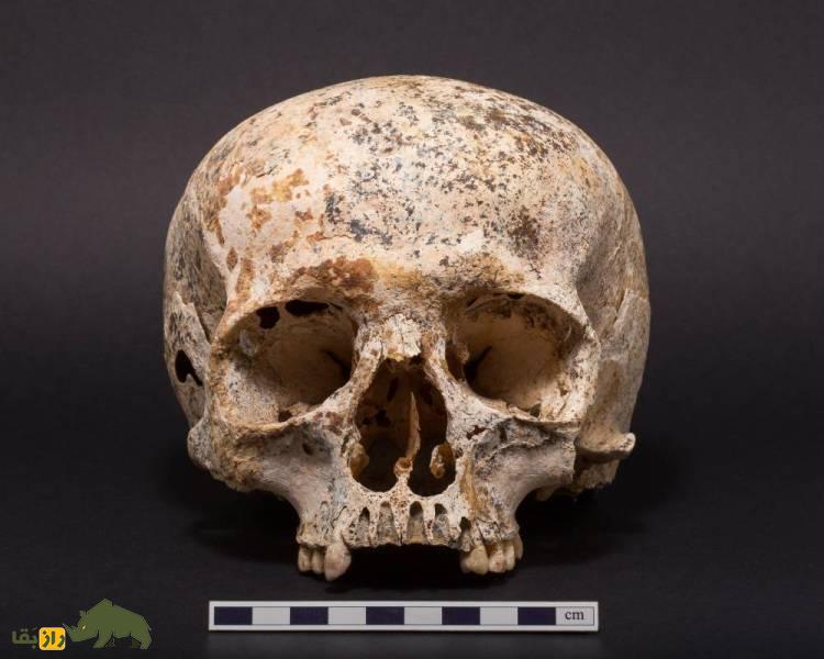 اسکلت انسان