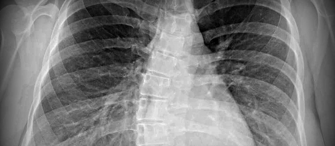 ماجرای خلق حوا از دنده آدم؛ آیا تعداد دندههای زن و مرد برابر است؟ ماجرای خلق حوا از دنده آدم؛ آیا تعداد دندههای زن و مرد برابر است؟