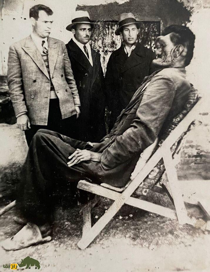سیاه خان لپویی؛ داستان «انسان جنزده» که عجیبالخلقهترین مرد ایران بود و اسکلت آن در شیراز نگهداری میشود سیاه خان لپویی