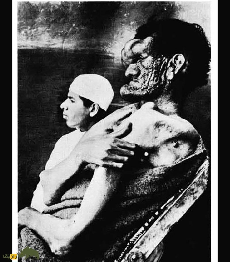 سیاه خان لپویی؛ عجیبترین مرد ایران که ۲ متر و ۶۰ سانتیمتر قد داشت و همه پزشکان دنیا عاشقش بودند! سیاه خان لپویی؛ عجیبترین مرد ایران که ۲ متر و ۶۰ سانتیمتر قد داشت و همه پزشکان دنیا عاشقش بودند!