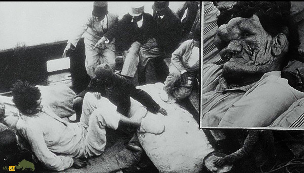 سیاه خان لپویی؛ داستان «انسان جنزده» که عجیبالخلقهترین مرد ایران بود و اسکلت آن در شیراز نگهداری میشود سیاه خان لپویی؛ داستان «انسان جنزده» که عجیبالخلقهترین مرد ایران بود و اسکلت آن در شیراز نگهداری میشود