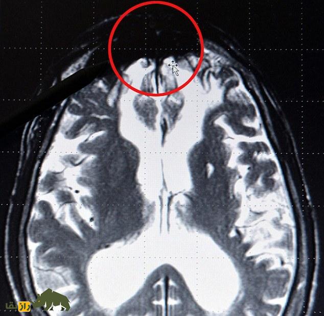 کشف یک راز عجیب در مغز دیکتاتورها و قاتلان؛ «لانه شیطان» چیست؟ کشف یک راز عجیب در مغز دیکتاتورها و قاتلان؛ «لانه شیطان» چیست؟