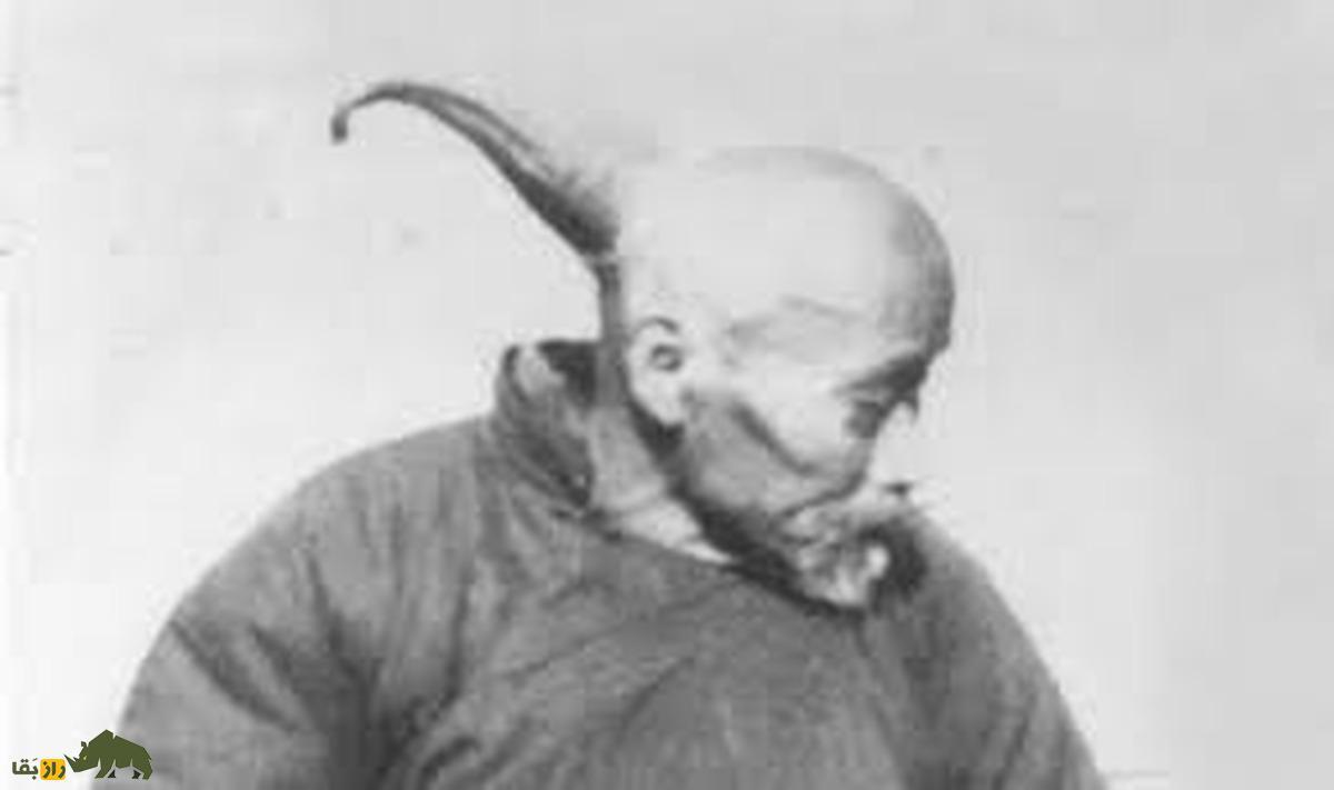 داستان تکاندهنده مرد گوریل نمایی که در جنگلهای برزیل کشف شد! مردی که شاخ دارد