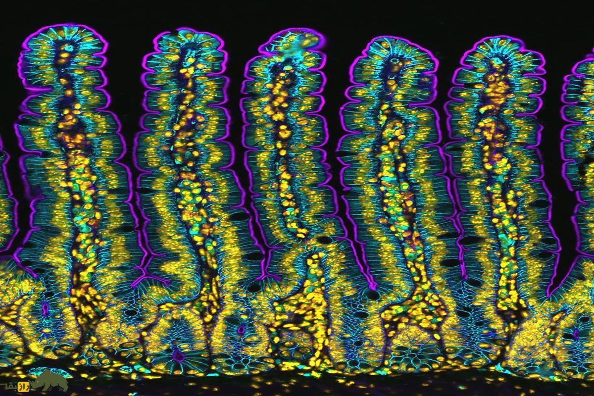 عکس میکروسکوپی از روده موش
