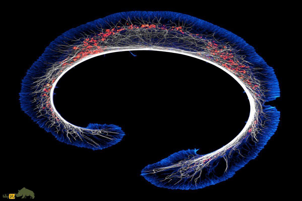 تومور بدخیم موش