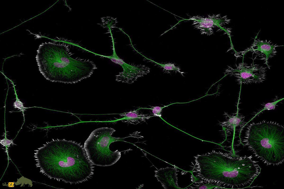عکس میکروسکوپی از مغز موش