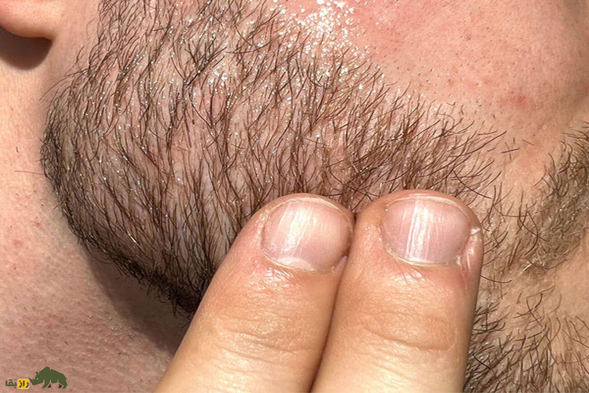 ریش و انگشت