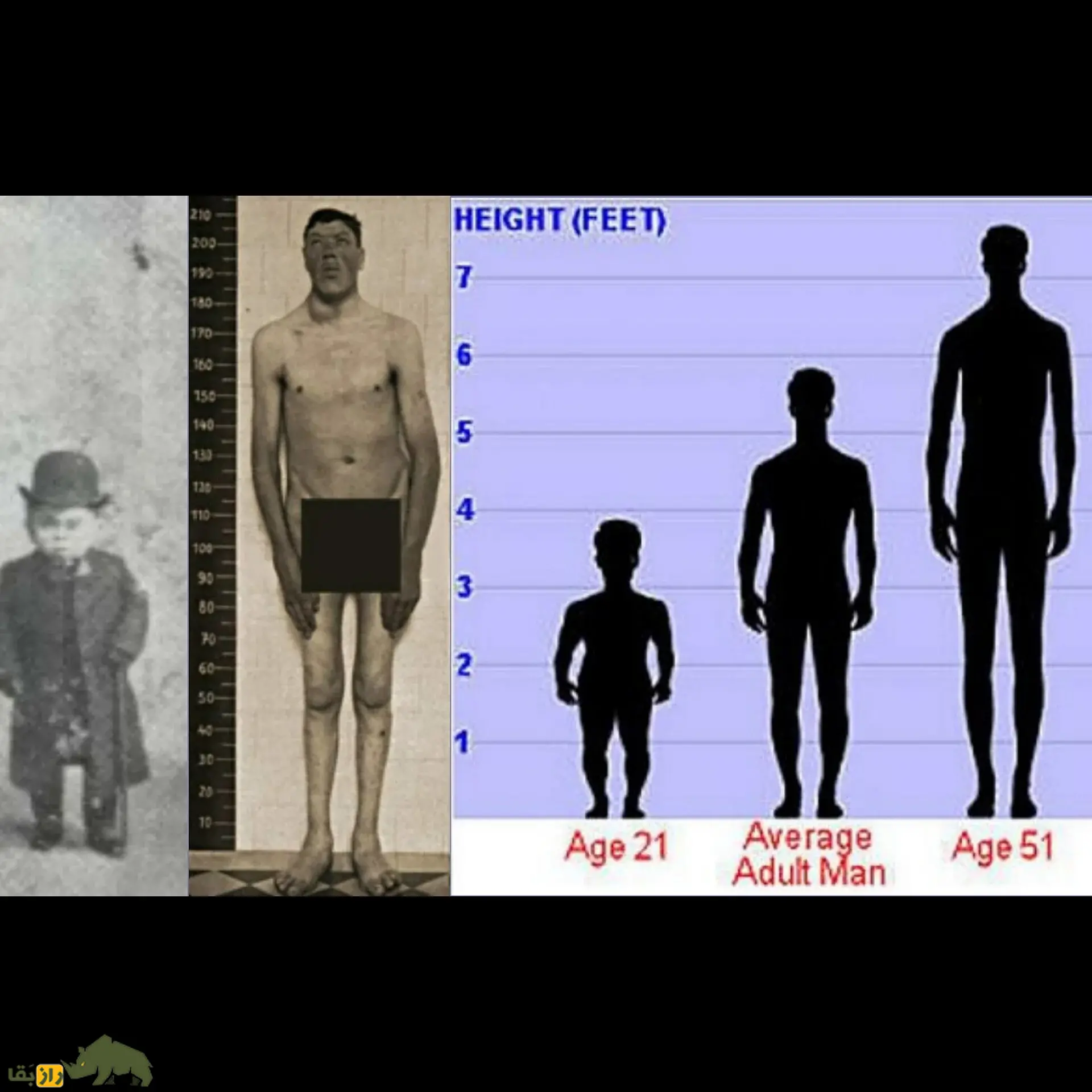 آدام راینر؛ مردی که کوتوله به دنیا آمد و غول از دنیا رفت! رشد عجیب او هنوز یکی از معماهای پزشکی است آدام راینر؛ مردی که کوتوله به دنیا آمد و غول از دنیا رفت! رشد عجیب او هنوز یکی از معماهای پزشکی است