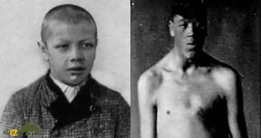 آدام راینر؛ مردی که کوتوله به دنیا آمد و غول از دنیا رفت! رشد عجیب او هنوز یکی از معماهای پزشکی است آدام راینر؛ مردی که کوتوله به دنیا آمد و غول از دنیا رفت! رشد عجیب او هنوز یکی از معماهای پزشکی است