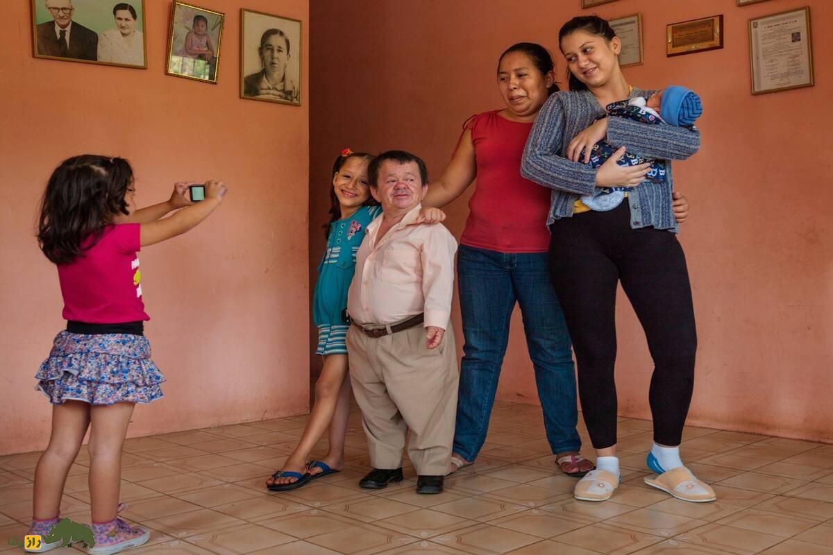 سندروم لارون؛ اختلال نادر با علائم کوتاهی قد، متابولیسم بهبود یافته و طول عمر بیشتر