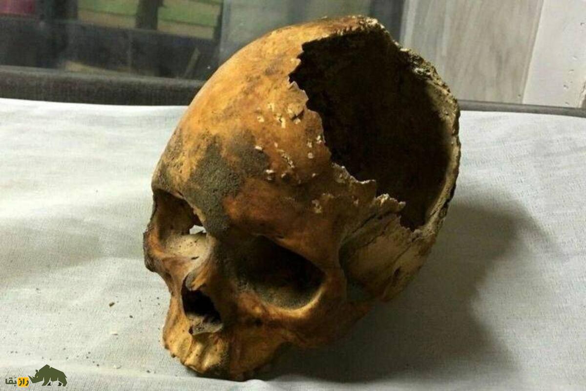 جمجمه ۹۰۰۰ ساله تپه عبدالحسین لرستان؛ راز تغییر شکل جمجمه در ایران باستان که نمیدانستید! جمجمه ۹۰۰۰ ساله تپه عبدالحسین لرستان؛ راز تغییر شکل جمجمه در ایران باستان که نمیدانستید!