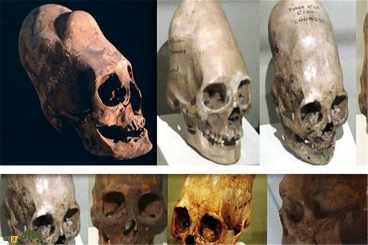 جمجمه ۹۰۰۰ ساله تپه عبدالحسین لرستان؛ راز تغییر شکل جمجمه در ایران باستان که نمیدانستید! جمجمه ۹۰۰۰ ساله تپه عبدالحسین لرستان؛ راز تغییر شکل جمجمه در ایران باستان که نمیدانستید!
