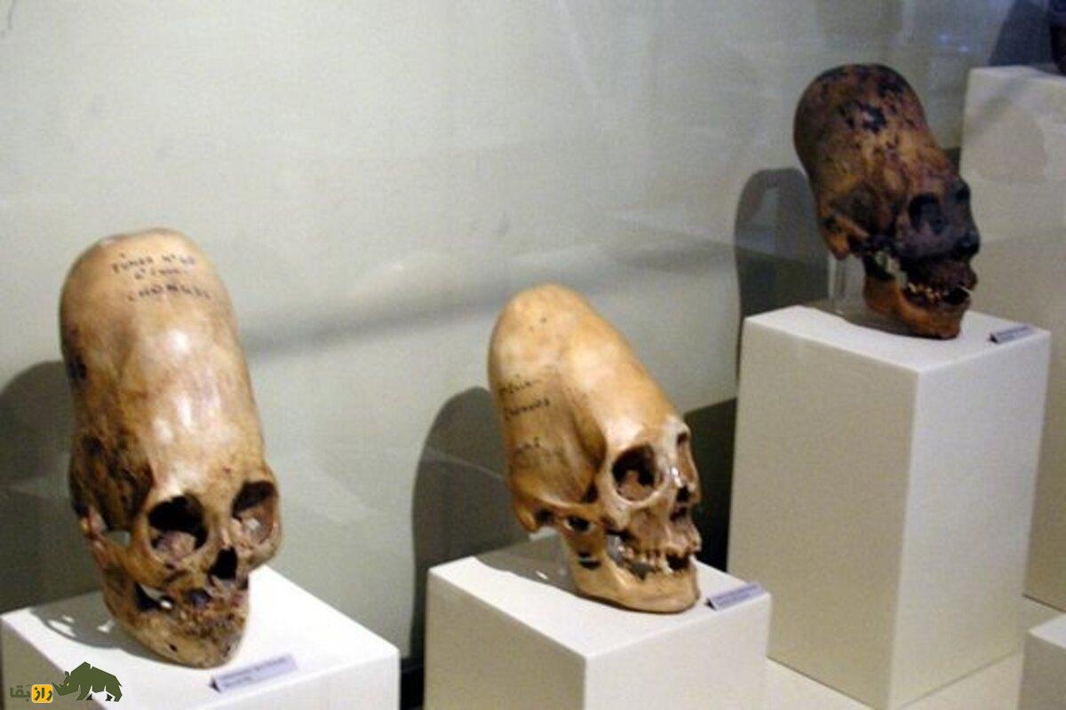 جمجمه ۹۰۰۰ ساله تپه عبدالحسین لرستان؛ راز تغییر شکل جمجمه در ایران باستان که نمیدانستید! جمجمه ۹۰۰۰ ساله تپه عبدالحسین لرستان؛ راز تغییر شکل جمجمه در ایران باستان که نمیدانستید!