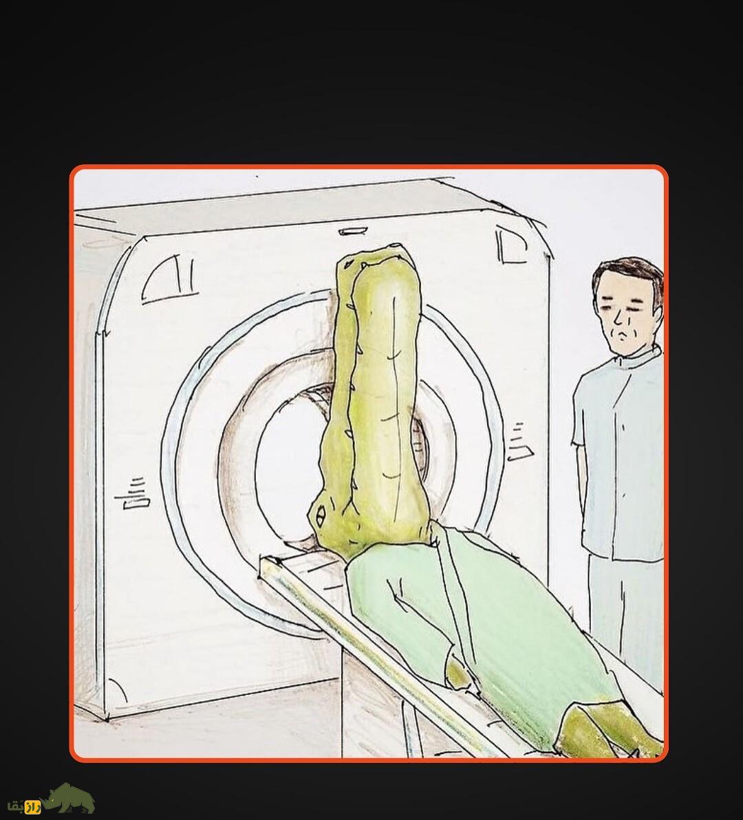 اگر انسان مانند تمساح پوزه داشت چی میشد؟ انسان با پوزه تمساح