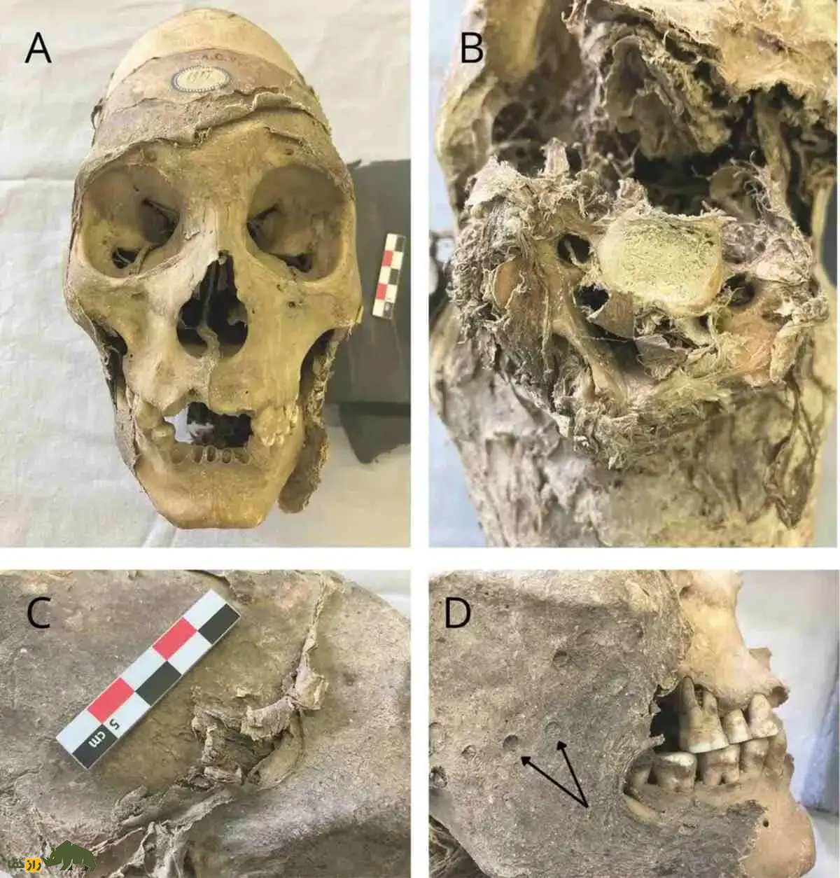 کشف شگفت‌انگیز سر مومیایی ۳۵۰ ساله بولیوی؛ راز‌های تراپاناسیون و تغییر شکل جمجمه آیمارا